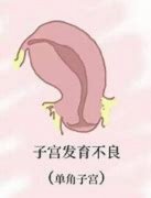 ӹʲôΣԹӤ